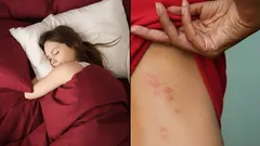 Ukryte szkodniki w łóżku: jak wykryć i skutecznie pozbyć się roztoczy kurzu